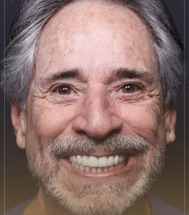 Paciente sorrindo com a reabilitação concluída