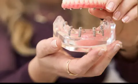 Mãos segurando um modelo de prótese protocolo sobre implantes